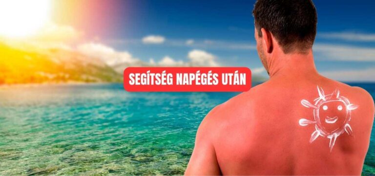Napégés regenerációja: 10 + 5 tipp