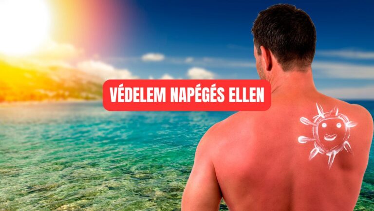 védelem napégés ellen