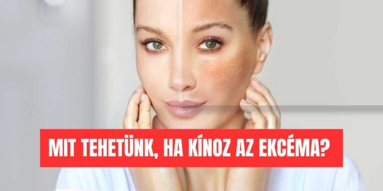 ekcémás bőr viszket, piros, száraz